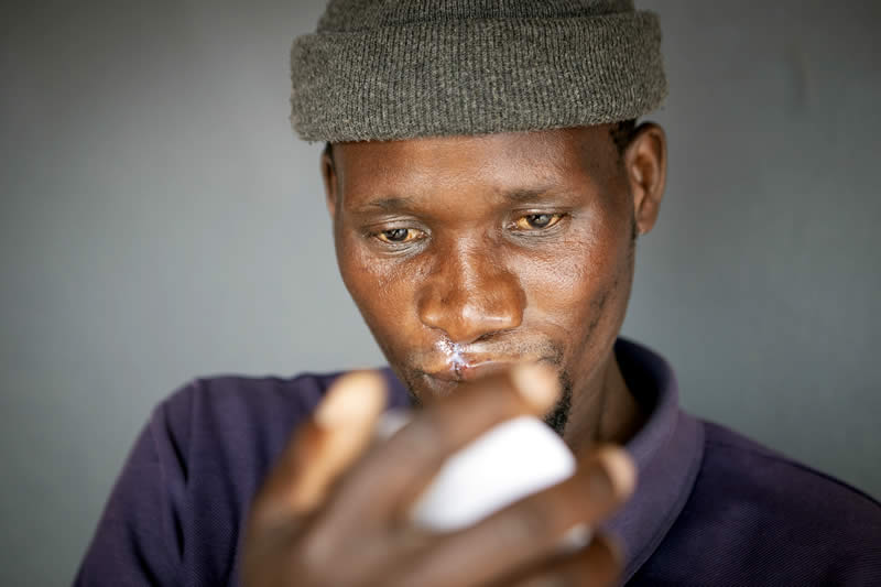 Zivezile Nojamanga after surgery