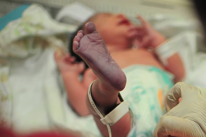 Birth defects 