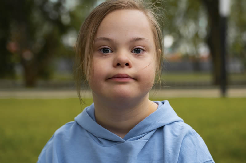 Down Syndrome