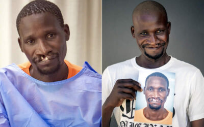 Zivezile update – a life transformed by cleft surgery