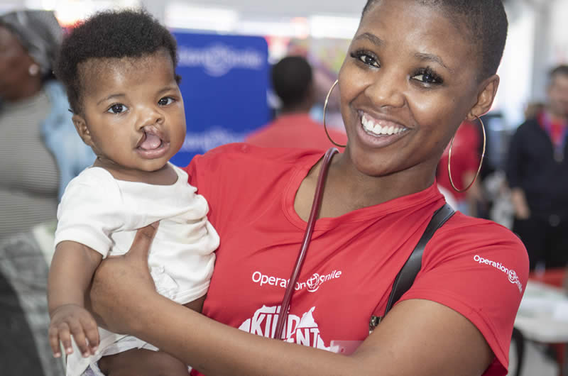 Eastern Cape cleft surgery