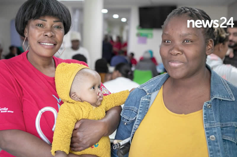 Kamohelo before surgery